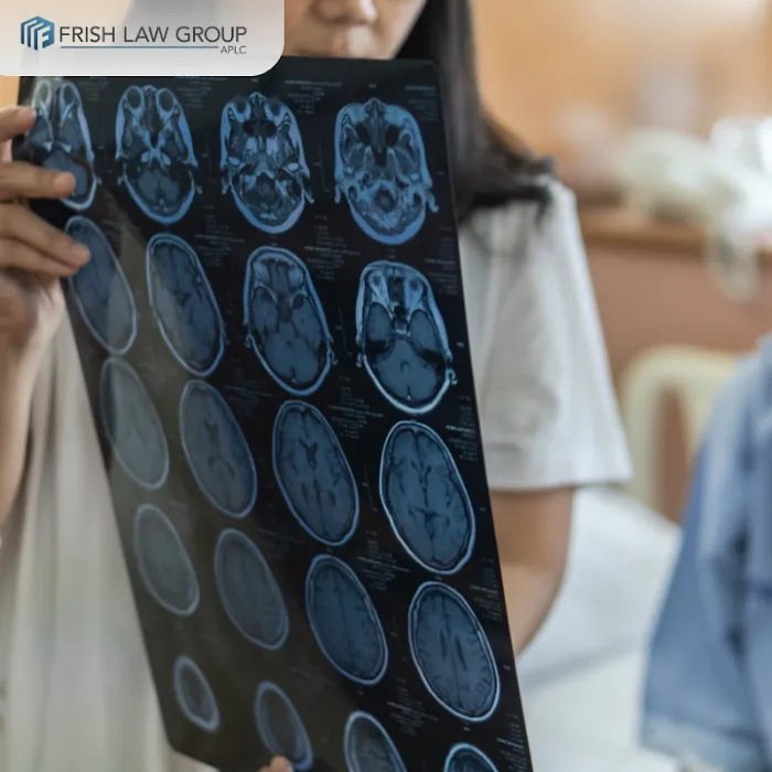 Frish Law Group, APLC | Personal Injury Attorney Los Angeles 7