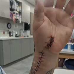 Lawbike Motorcycle Injury Lawyers ico