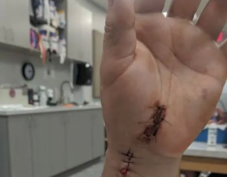 Lawbike Motorcycle Injury Lawyers