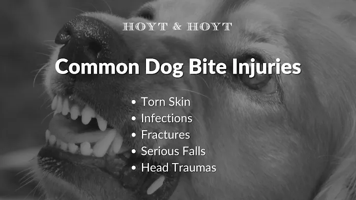 Hoyt & Hoyt 8