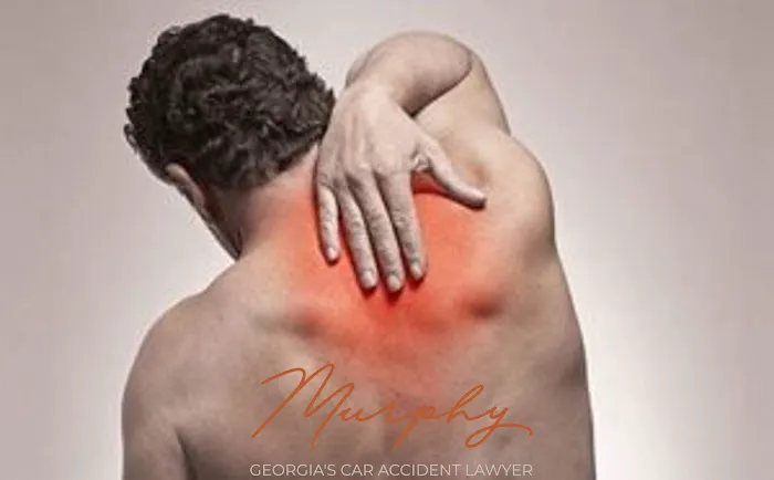 Murphy Law Georgia's Car Accident Lawyer 5